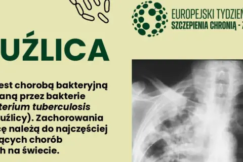 Gruźlica to choroba bakteryjna. Na zdjęciu RTG klatki piersiowej widoczne są zmiany typowe dla gruźlicy.