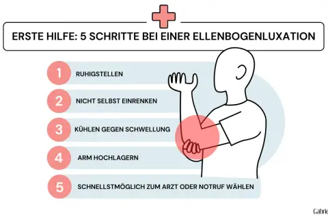 Erste Hilfe bei einem ellenbogen ausgekugelt: Ruhigstellen, nicht selbst einrenken, kühlen, Arm hochlagern, Arzt rufen.