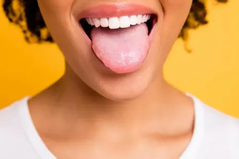 Bocca aperta con lingua rosa che sporge, un po' di bianco si nota, forse perchè ho la lingua bianca. Sorriso smagliante su sfondo giallo.
