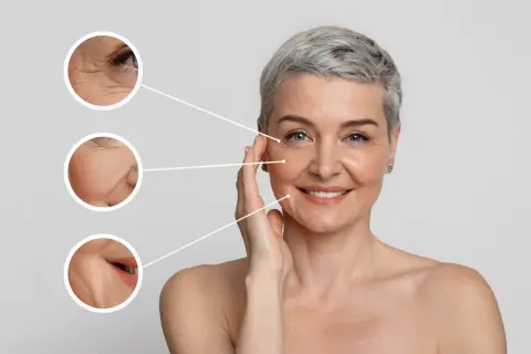 Mujer sonriente con piel madura. Se muestran primeros planos de arrugas en ojos, mejillas y boca, sugiriendo tratamientos para quitar arrugas frente y otras zonas.