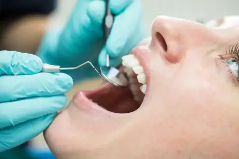 Dentysta bada zęby pacjentki, oceniając przeciwwskazania do lakierowania.