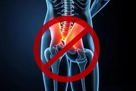 Illustration av bäckenet med markerad smärta, symboliserar att det är stopp för ont i piriformis.