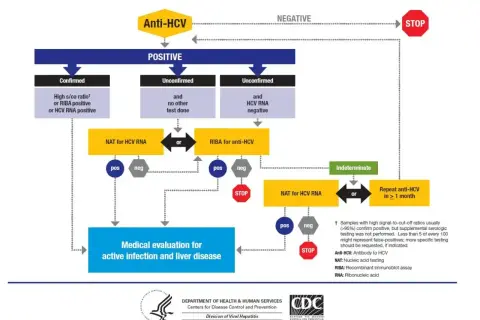 Schemat diagnostyki zakażenia HCV: od testu Anti-HCV, przez wyniki pozytywne, niepotwierdzone, do oceny medycznej. Dowiedz się, hcv co to.