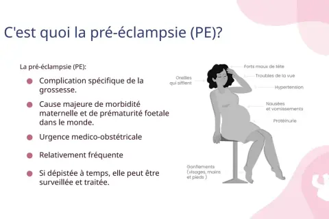 Illustration expliquant la pré-éclampsie et ses symptômes : maux de tête, troubles de la vue, hypertension, nausées, vomissements, protéinurie, sifflements d'oreilles et gonflements.