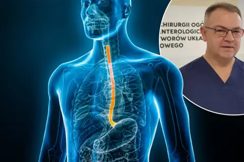Anatomia przełyku z zaznaczonym obszarem, który może wskazywać na raka przełyku objawy. Obok lekarz w granatowym uniformie.