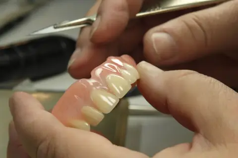 Dłoń trzyma protezę na implantach NFZ, gotową do dopasowania.