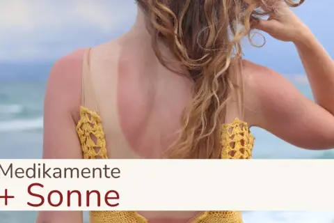 Sonnenbrand am Rücken einer Frau, die Medikamente einnimmt. Vorsicht bei Antibiotika und Sonne!