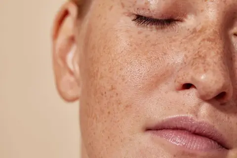Nahaufnahme eines Gesichts mit Sommersprossen. Die Haut wirkt frisch und strahlend, was auf die positive carnosin wirkung hindeuten könnte.