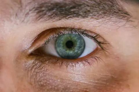 Occhio con iride verde-blu e segni di stanchezza sotto. Scopri come far sparire le occhiaie per uno sguardo più riposato.