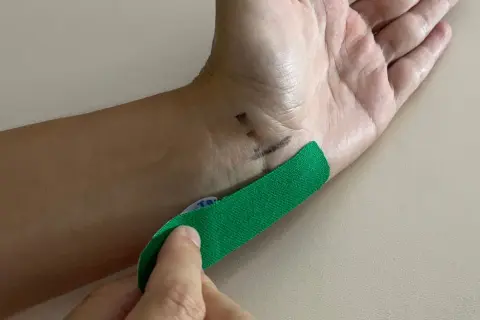 Hand mit grünen Tape, das auf das Handgelenk geklebt wird, um Taubheitsgefühl im kleinen Finger zu lindern.