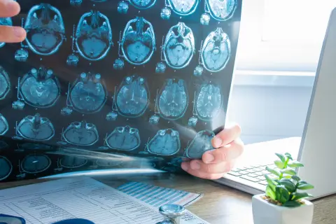Un médecin examine un IRM cérébral, cherchant des indices sur l'oreille interne.