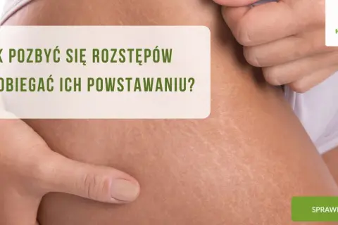 Jak Zapobiec Rozstępom? Skuteczne Metody i Pielęgnacja Skóry