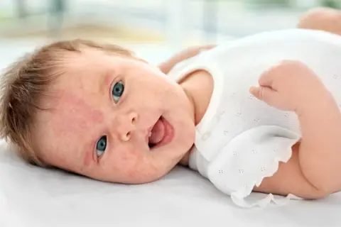 Söt bebis med blå ögon och lite babyakne på kinderna, glad och skrattande.