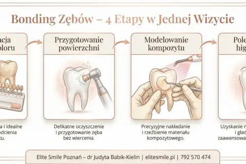 Bonding zębów: konsultacja, przygotowanie, modelowanie kompozytu i polerowanie. Zabieg nie niszczy zębów, a jedynie je upiększa.