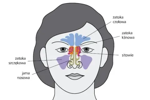 Skuteczne leki na zapalenie zatok - ulga w bólu i dyskomforcie