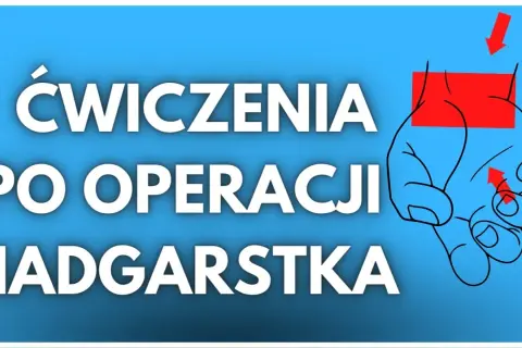Jakie ćwiczenia po zabiegu cieśni nadgarstka pomogą w szybkiej rehabilitacji