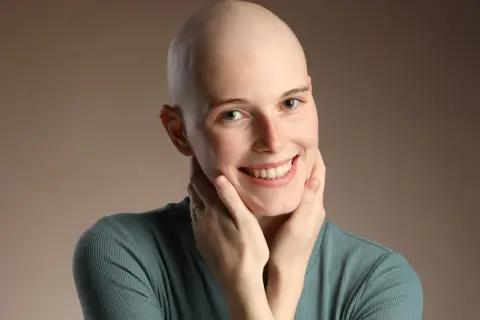 Lächelnde Frau mit Glatze, die ihre Wangen berührt. Ihre positiven Lymphom Chemotherapie Erfahrungen strahlen aus ihr.