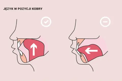 Prawidłowa pozycja języka: Jak ćwiczyć i dlaczego to ważne?