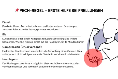 Erste Hilfe bei Prellungen: PECH-Regel erklärt. Bei einer Prellung am Unterarm sofort Pause machen, Eis kühlen, Compression anlegen und den Arm hochlagern.