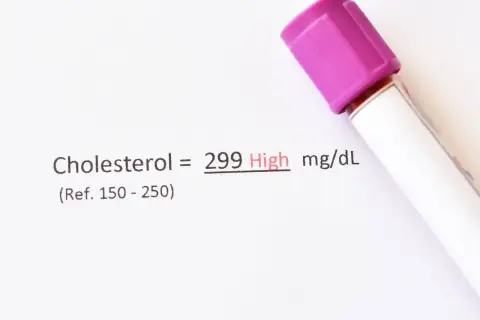 Wynik cholesterolu 299 mg/dL, co oznacza wysoki poziom. To może być sygnał, by przyjrzeć się diecie i rozważyć ezehron.