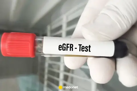 Rękawiczka trzyma probówkę z napisem "eGFR - Test". Wynik eGFR jest kluczowy dla oceny pracy nerek.