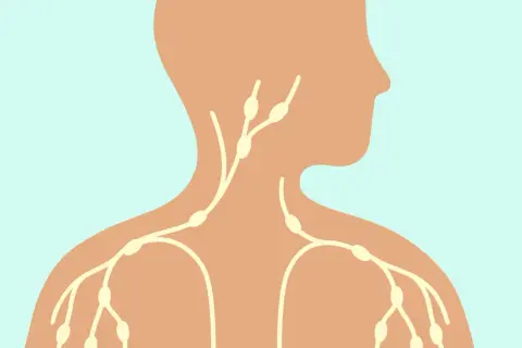 Schéma du système lymphatique montrant des ganglions dans le cou, qui peuvent être un ganglion cou douloureux au toucher.
