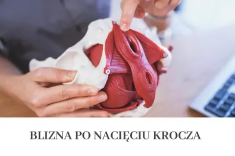 Jak dbać o krocze po porodzie: skuteczne sposoby na szybsze gojenie i komfort