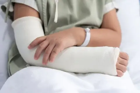 Złamanie łokcia ile gips – ile czasu musisz nosić gips?