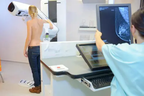 Frau wird mittels 3D Mammographie untersucht. Ärztin analysiert das Bild auf dem Monitor.