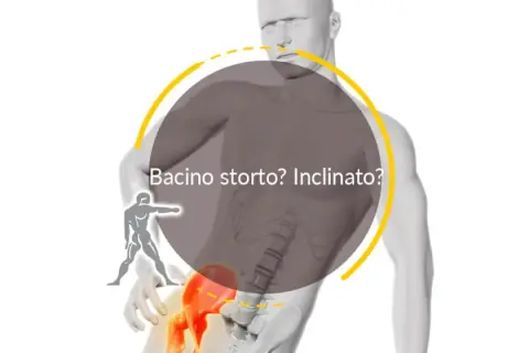 Un bacino ruotato o inclinato può causare dolore. L'osteopata può aiutarti a riallinearlo.