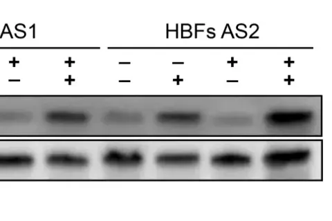 Western blot pokazujący poziom fosforylacji Smad1/5/9 w komórkach HBFs AS1 i AS2 po traktowaniu TGF-β₁ i ISL.