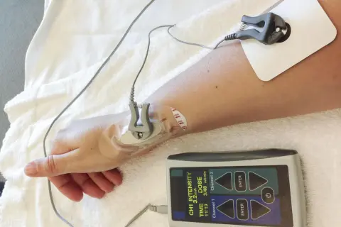Ramię pacjenta podłączone do urządzenia do jonoforezy. Elektrody i panel sterowania z widocznymi parametrami.