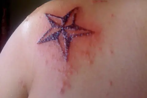 Un tatuaje de estrella en el hombro, con piel enrojecida y con pequeños bultos alrededor. Es normal que pique un tatuaje después de meses.
