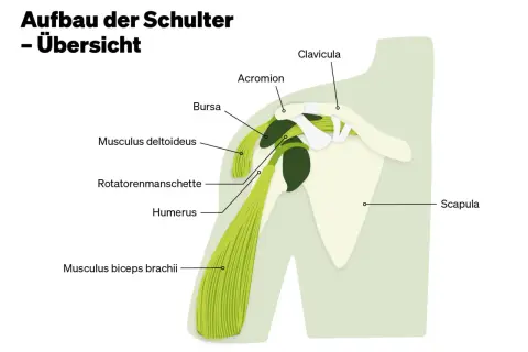 Schulteranatomie: Schulterblatt (Scapula), Oberarmknochen (Humerus), Schlüsselbein (Clavicula), Acromion, Bursa, Deltamuskel (Musculus deltoideus), Bizepssehne (Musculus biceps brachii) und Rotatorenmanschette. Der Levator scapulae ist hier nicht expli...