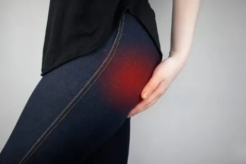 Une main touche la hanche, une zone rouge indiquant une douleur liée au syndrome fessier profond.