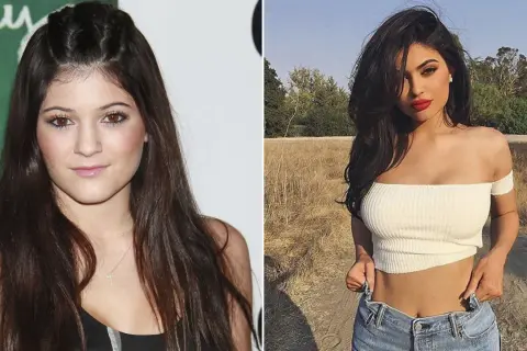 Kylie Jenner antes y después: un vistazo a su transformación.