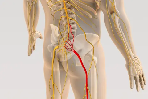 Anatomia nerwu kulszowego zaznaczonego na czerwono na tle kręgosłupa i miednicy.