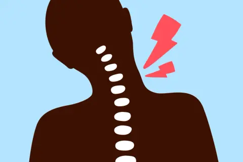 Silhouette d'une personne avec une colonne vertébrale visible, symbolisant une nuque bloquée et une douleur vive.