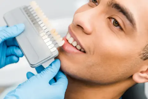 Dobór idealnego koloru licówek na jedynki. Dentysta w niebieskich rękawiczkach prezentuje wzornik odcieni.