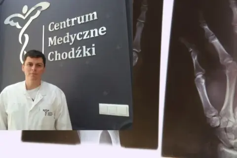 Lekarz w białym fartuchu na tle logo "Centrum Medyczne Chodźki" i zdjęcia RTG dłoni.