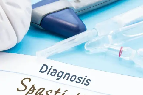 Medyczne narzędzia i ampułki na niebieskim tle. Na papierze widnieje napis "Diagnosis Spastyczność mięśni".