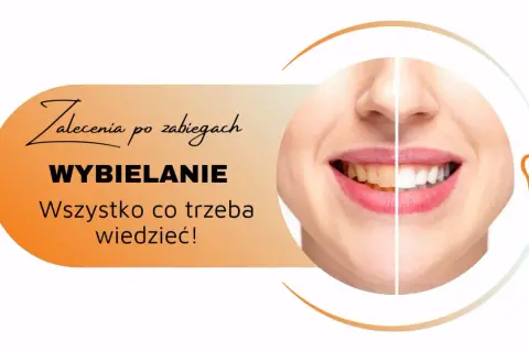 Zalecenia po zabiegach wybielania zębów. Uśmiech przed i po, by cieszyć się olśniewającą bielą.