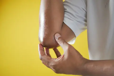 Un codo seco y áspero es tocado por una mano.