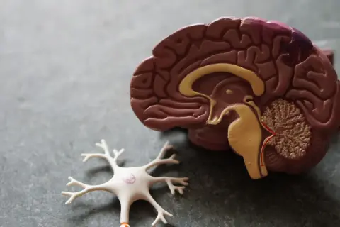 Model mózgu i neuron. Udar mózgu może prowadzić do zaburzeń percepcji, takich jak urojenia po udarze mózgu.