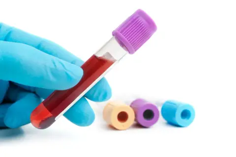 Ręka w niebieskiej rękawiczce trzyma probówkę z krwią. W tle inne probówki. Badanie hemoglobiny glikowanej - norma.