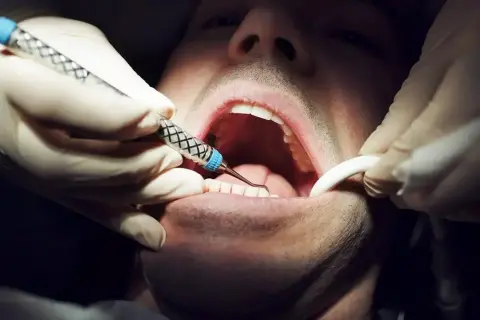Co oznacza sen o dentyście? Odkryj ukryte lęki i emocje