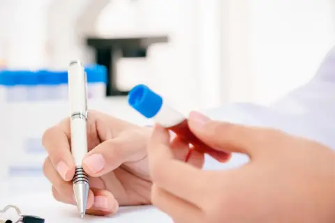 Badacz analizuje próbkę krwi, badając potencjalny związek między niedoborem sodu a rakiem.