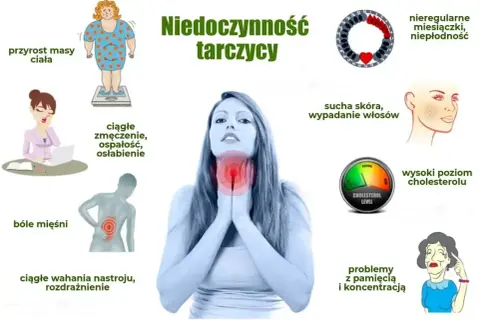 Niedoczynność tarczycy objawy: przyrost masy ciała, zmęczenie, bóle mięśni, wahania nastroju, sucha skóra, wypadanie włosów, problemy z pamięcią.