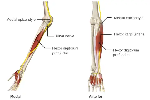 Anatomie des Arms: Nerven und Muskeln. Der Nervus ulnaris verläuft am medialen Epikondylus entlang und versorgt den Flexor digitorum profundus.
