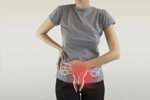 Donna con mani sull'addome, evidenziato un disegno dell'utero con aree rosse. Possibili cause di ovulazione dolorosa.